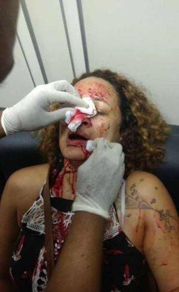 Professora brutalmente agredida durante a manifestação em SP